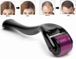 Etszaz 540 Micro 0.5mm Titanium Alloy Needles Beard Health and Development (50 g)